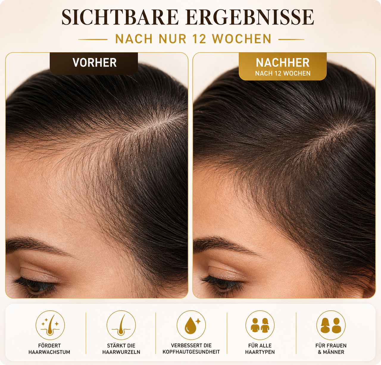 EB Haar Roller